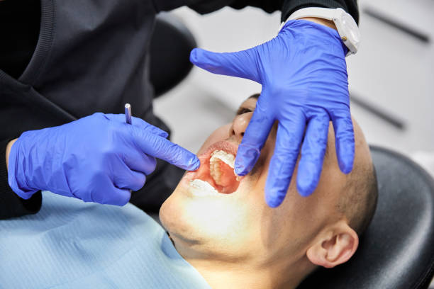 Best Emergency Dental Extractions in Reamstown, PA